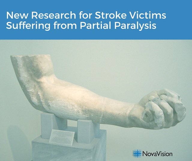 New Research For Stroke Victims Suffering From Partial Paralysis