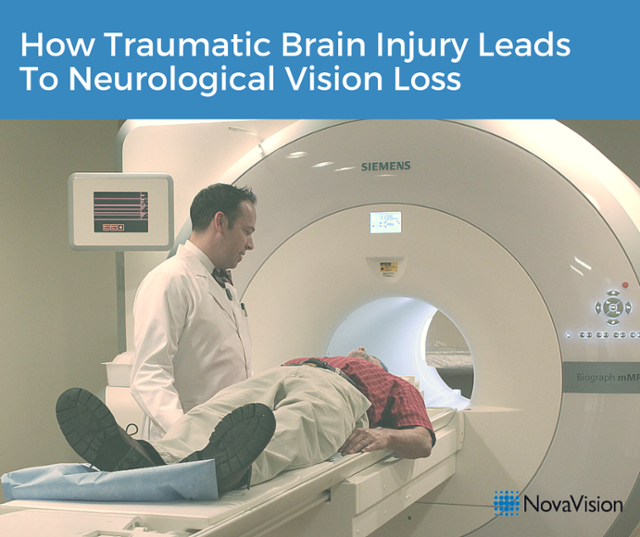 How Traumatic Brain Injury Leads To Neurological Vision Loss