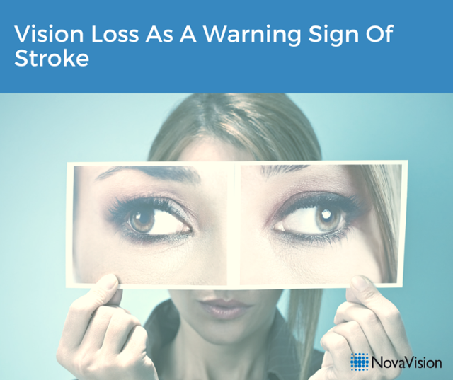 Vision Loss As A Warning Sign Of Stroke