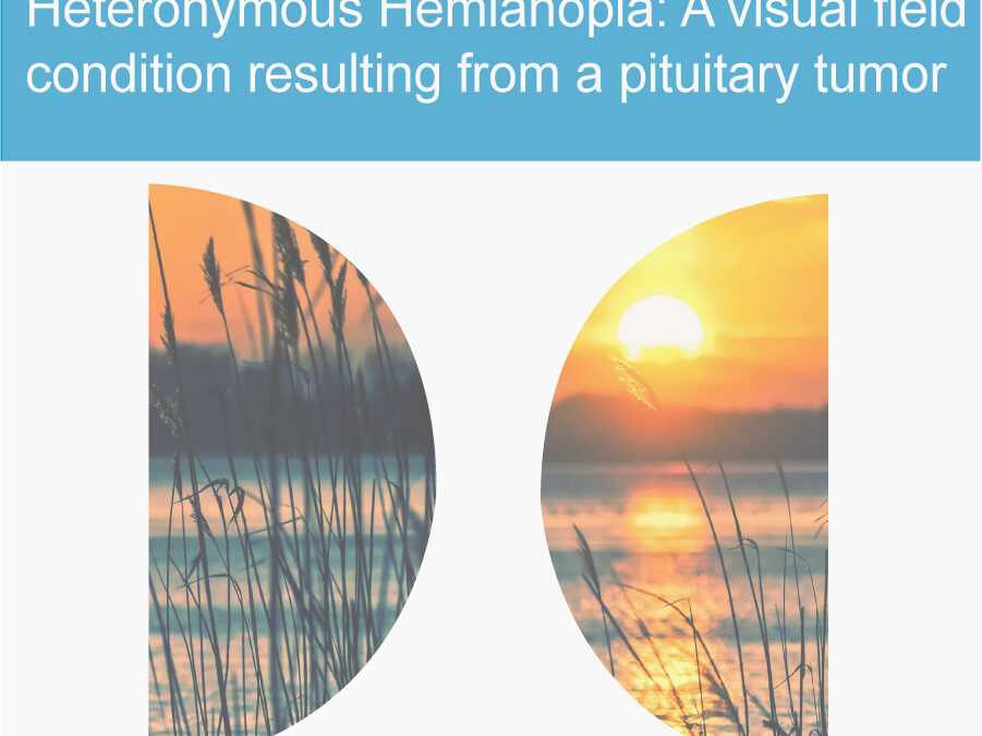 Heteronymous Hemianopia: A Visual Field Condition Resulting From A Pituitary Tumor